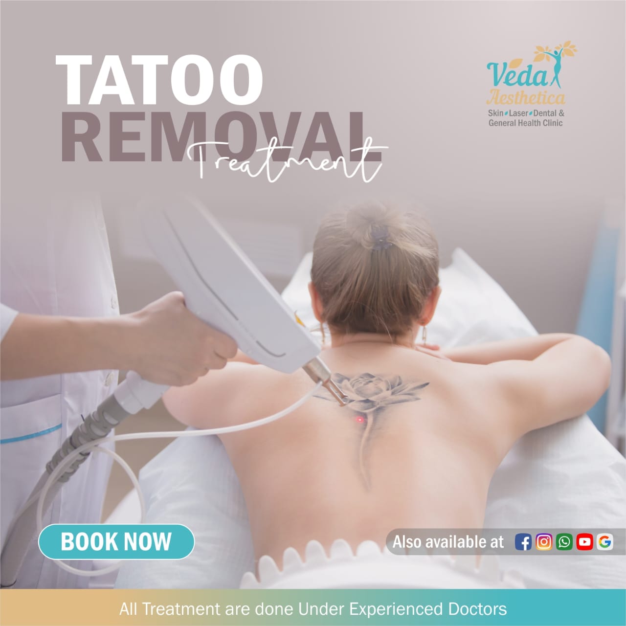 Tattoo Removal